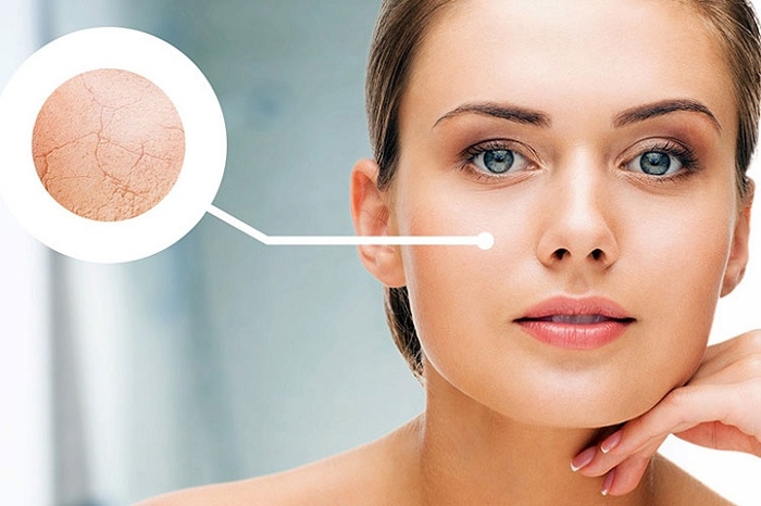 cach cham soc da thieu nuoc thieu am hieu qua