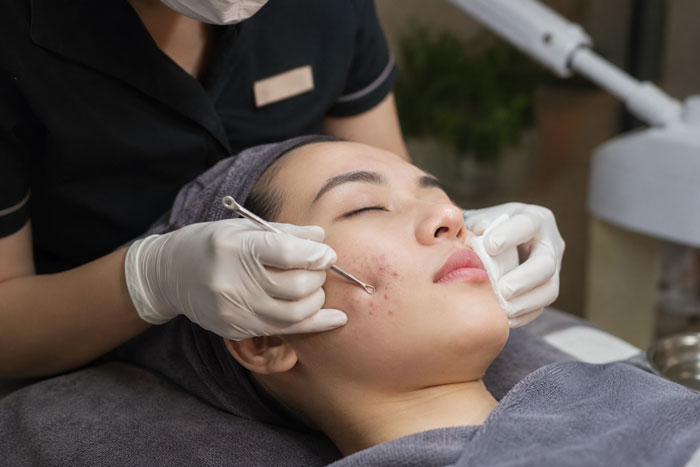 co nen nan mun tai spa  nhung dieu ban can biet