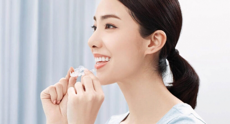 co nen nieng rang trong suot invisalign khong