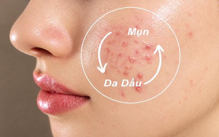 da dau mun nen skincare nhu the nao moi ngay