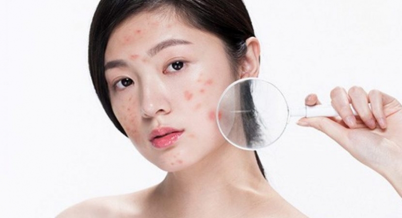 mun trung ca  nguyen nhan va cach phong ngua hieu qua