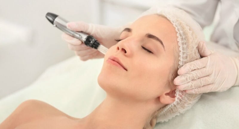 nhung dieu can biet ve lan kim tri mun