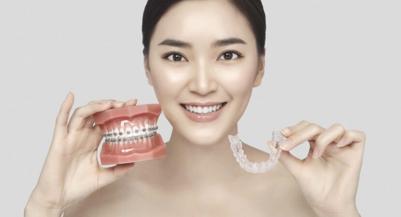 nieng rang trong suot la gi  co may loai nieng rang trong suot