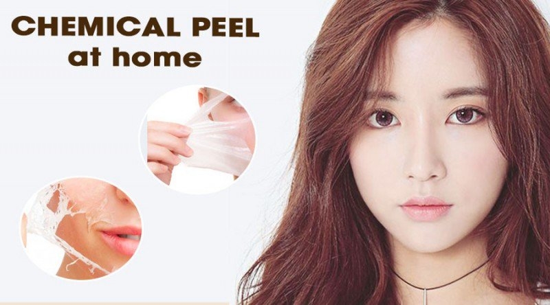 peel da co tot khong  uu diem va nhuoc cua peel da la gi