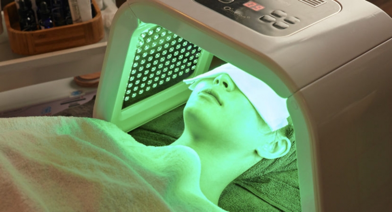 peel da nhu the nao va nhung dieu can biet