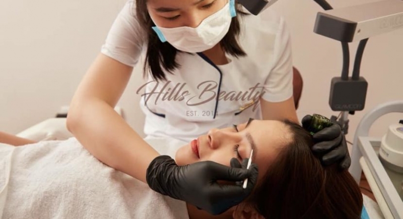 so sanh 3 phuong phap tham mi long may hot nhat