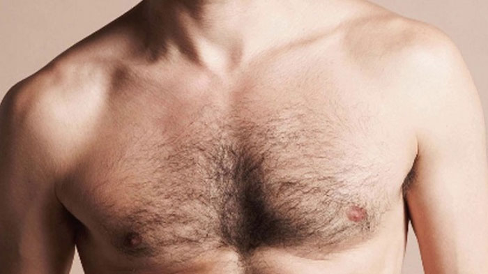 tinh trang long moc nhieu qua muc la tot hay xau