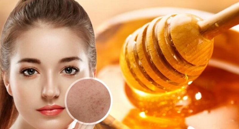 top 5 cach lam mat na mat ong tri mun cap toc