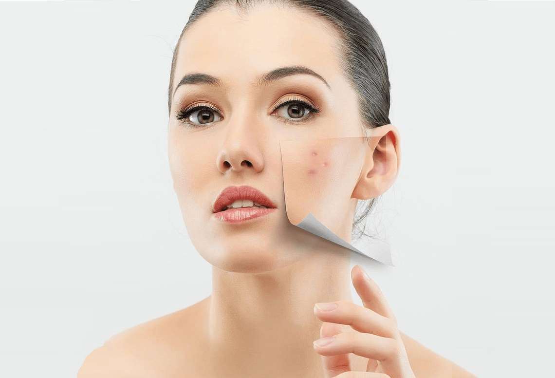 Review về phương pháp thay da sinh học học cho da mặt | HillsBeauty.vn